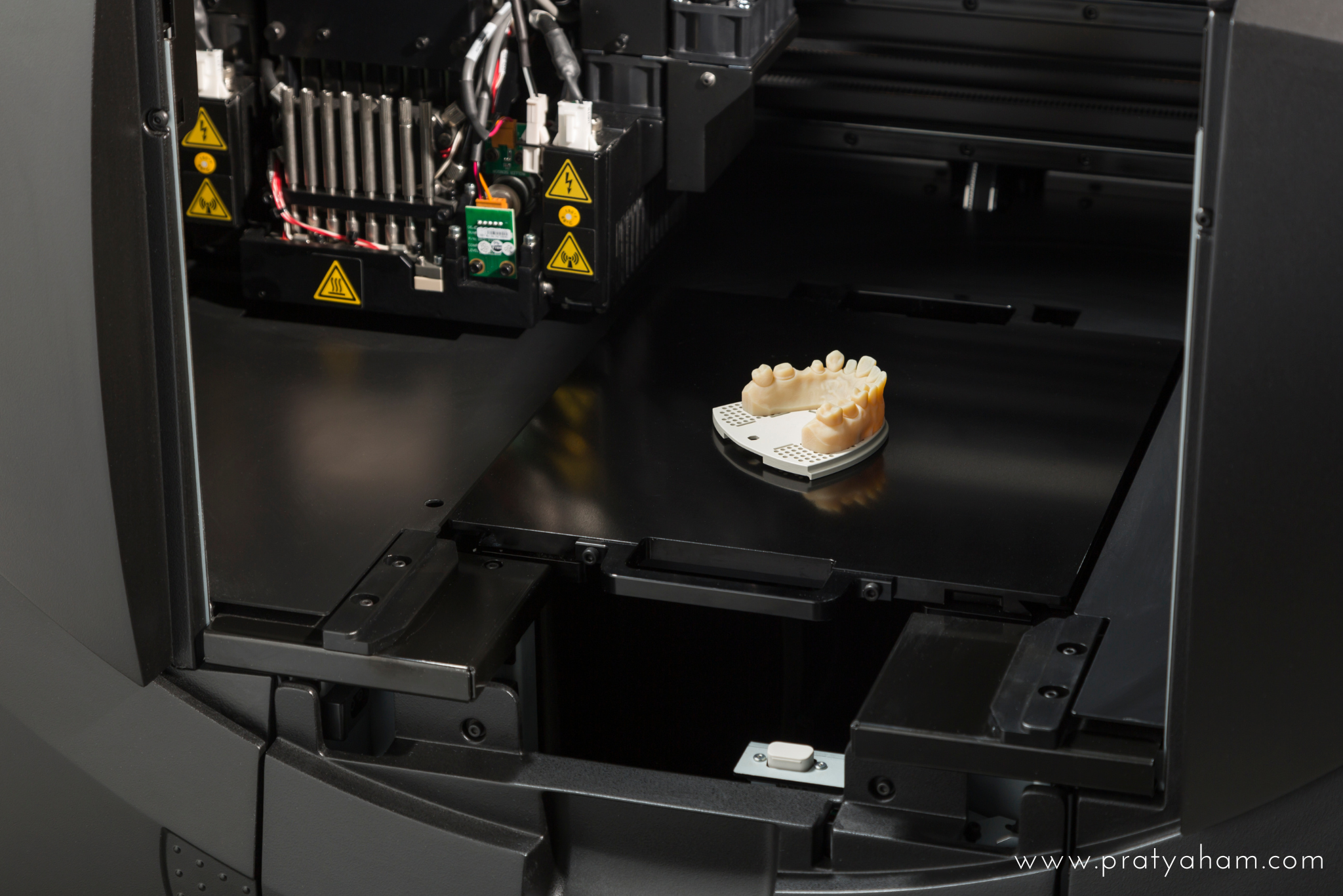 3D Bioprinting: The Future of Custom Implants and Prosthetics